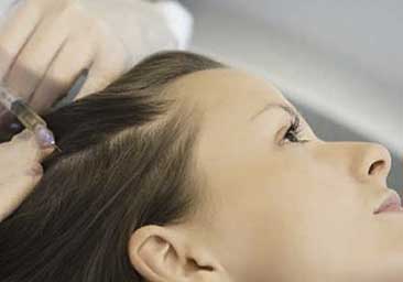 Мезотерапия кожи головы препаратом Filorga в салоне красоты на Проспекте Вернадского