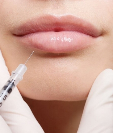 Контурная пластика губ в салоне красоты на Проспекте Вернадского
